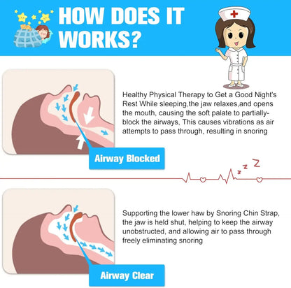 Illustration explaining how the SnoreShift Chin Strap opens airways to prevent snoring for better sleep.